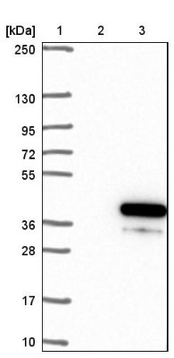 Western Blot: C20orf111 Antibody [NBP1-91725] - Lane 1: Marker [kDa] 250, 130, 95, 72, 55, 36, 28, 17, 10. Lane 2: Negative control (vector only transfected HEK293T lysate). Lane 3: Over-expression lysate (Co-expressed with a C-terminal myc-DDK tag (3.1 kDa) in mammalian HEK293T cells).