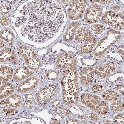 Immunohistochemistry-Paraffin: C20orf111 Antibody [NBP1-91725] - Staining of human kidney shows moderate cytoplasmic and nuclear positivity in cells in tubules.