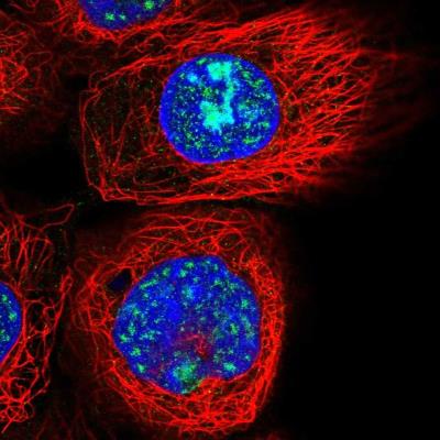 Immunofluorescence: C20orf111 Antibody [NBP1-91725] - Immunofluorescent staining of human cell line A-431 shows localization to nucleoli & nuclear speckles. Antibody staining is shown in green.