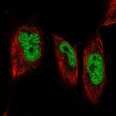 Immunocytochemistry/Immunofluorescence: GMEB1 Antibody [NBP1-91949] - Immunofluorescent staining of human cell line U-251 MG shows localization to nucleoplasm.