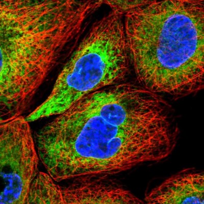 Immunocytochemistry/Immunofluorescence: GDAP2 Antibody [NBP1-91932] - Immunofluorescent staining of human cell line A-431 shows localization to endoplasmic reticulum.