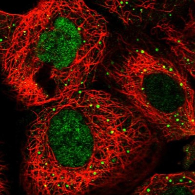 Immunocytochemistry/Immunofluorescence: RFC3 Antibody [NBP1-82668] - Immunofluorescent staining of human cell line A-431 shows localization to nucleoplasm & vesicles.