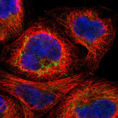 Immunocytochemistry/Immunofluorescence: MTIF2 Antibody [NBP1-81609] - Immunofluorescent staining of human cell line A-431 shows localization to mitochondria.