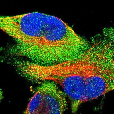 Immunocytochemistry/Immunofluorescence: TRIM16 Antibody [NBP1-84921] - Staining of human cell line U-251 MG shows positivity in cytoplasm.