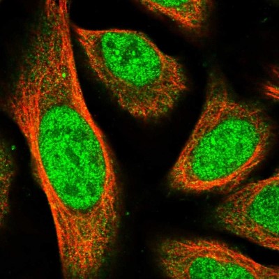 Immunocytochemistry/Immunofluorescence: MPP3 Antibody [NBP1-85015] - Immunofluorescent staining of human cell line U-2 OS shows localization to nucleoplasm & cytosol.