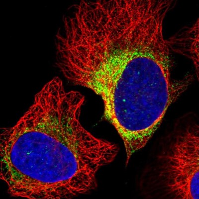 Immunocytochemistry/Immunofluorescence: ASTE1 Antibody [NBP1-81661] - Immunofluorescent staining of human cell line U-2 OS shows localization to endoplasmic reticulum.
