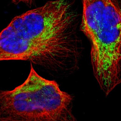 Immunocytochemistry/Immunofluorescence: CECR5 Antibody [NBP1-86136] - Immunofluorescent staining of human cell line U-2 OS shows localization to mitochondria.