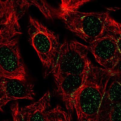 Immunocytochemistry/Immunofluorescence: DPEP1 Antibody [NBP1-86087] - Staining  human cell line Hep G2 shows positivity in nucleus and cell junctions. Antibody staining is shown in green.