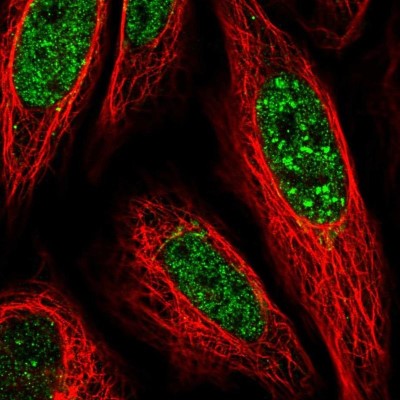 Immunocytochemistry/Immunofluorescence: PLSCR4 Antibody [NBP1-86165] - Staining of human cell line SiHa shows localization to nucleoplasm & nuclear bodies.