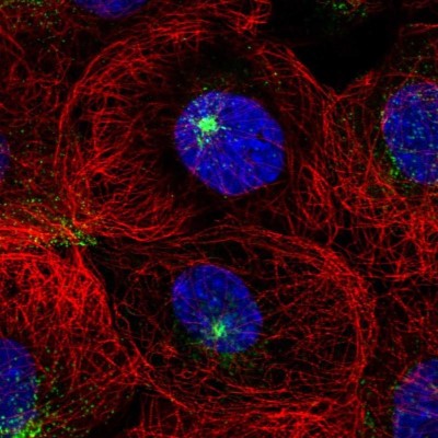 Immunocytochemistry/Immunofluorescence: DPYS Antibody [NBP1-85224] - Staining of human cell line A-431 shows positivity in vesicles and centrosome.