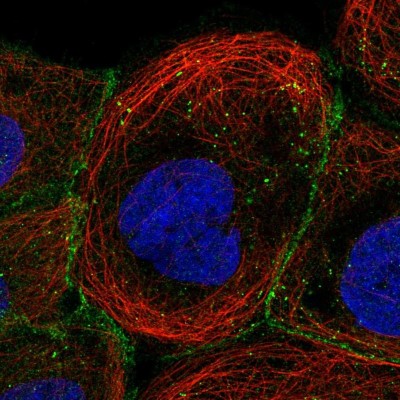 Immunocytochemistry/Immunofluorescence: PGS1 Antibody [NBP1-85022] - Immunofluorescent staining of human cell line A-431 shows localization to plasma membrane, cell junctions & vesicles.