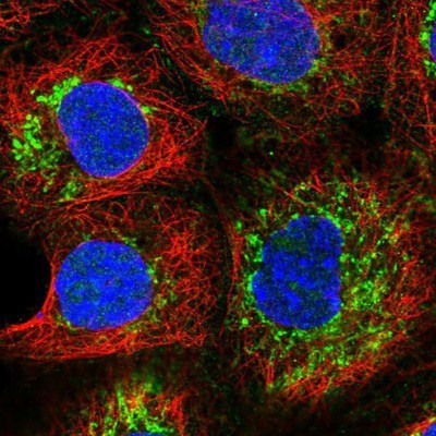 Immunocytochemistry/Immunofluorescence: SLC25A10 Antibody [NBP1-85214] - Staining of human cell line A-431 shows positivity in mitochondria.