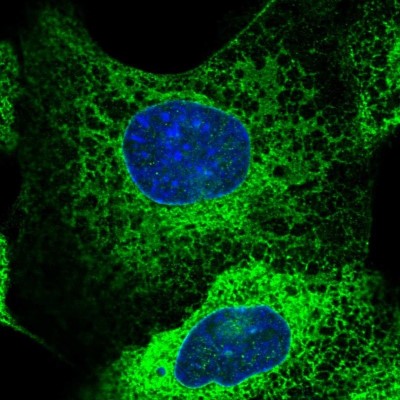 Immunocytochemistry/Immunofluorescence: GBP5 Antibody [NBP1-85947] - Immunofluorescent staining of human cell line A-431 shows localization to endoplasmic reticulum.