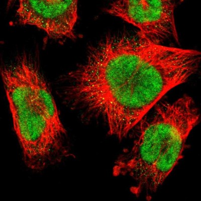 Immunocytochemistry/Immunofluorescence: RBM7 Antibody [NBP1-86080] - Immunofluorescent staining of human cell line U-251 MG shows localization to nucleus.