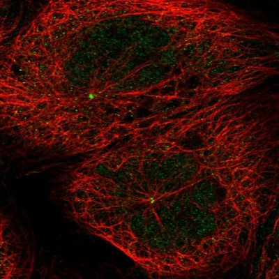 Immunocytochemistry/Immunofluorescence: C10orf107 Antibody [NBP1-88738] - Staining of human cell line A-431 shows positivity in nucleus, cytoplasm and centrosome.