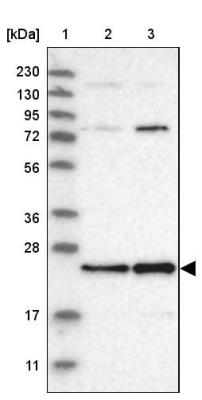 Western Blot: C7orf30 Antibody [NBP1-86026] - Lane 1: Marker  [kDa] 230, 130, 95, 72, 56, 36, 28, 17, 11.  Lane 2: Human cell line RT-4.  Lane 3: Human cell line U-251MG sp