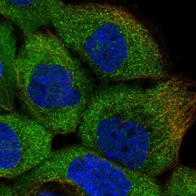 Immunocytochemistry/Immunofluorescence: ERK3/MAPK6 Antibody [NBP1-84806] - Immunofluorescent staining of human cell line A-431 shows localization to cytosol.