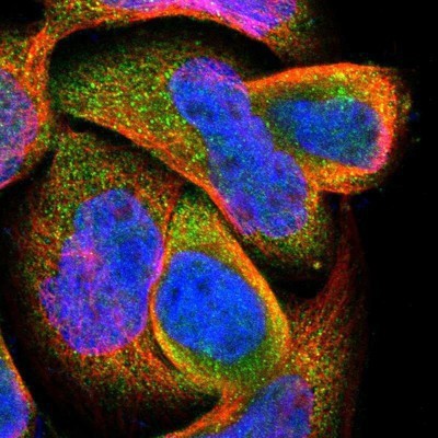 Immunocytochemistry/Immunofluorescence: DPP8 Antibody [NBP1-84993] - Staining of human cell line A-431 shows positivity in cytoplasm.