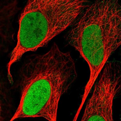 Immunocytochemistry/Immunofluorescence: RNMT Antibody [NBP1-80841] - Immunofluorescent staining of human cell line U-2 OS shows localization to nucleoplasm.