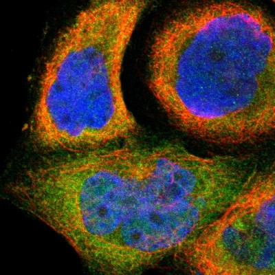Immunocytochemistry/Immunofluorescence: SH2D4A Antibody [NBP1-82158] - Immunofluorescent staining of human cell line A-431 shows localization to cytosol.