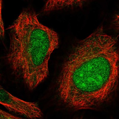Immunocytochemistry/Immunofluorescence: CLDND1 Antibody [NBP1-86790] - Immunofluorescent staining of human cell line U-2 OS shows localization to nucleus & nucleoli.