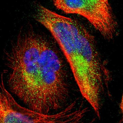 Immunocytochemistry/Immunofluorescence: PTS Antibody [NBP1-87187] - Immunofluorescent staining of human cell line U-251 MG shows localization to cytosol.