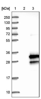 Western Blot: C16orf45 Antibody [NBP1-81996] - Lane 1: Marker [kDa] 250, 130, 95, 72, 55, 36, 28, 17, 10. Lane 2: Negative control (vector only transfected HEK293T lysate). Lane 3: Over-expression lysate (Co-expressed with a C-terminal myc-DDK tag (3.1 kDa) in mammalian HEK293T cells).