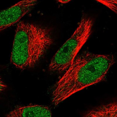 Immunocytochemistry/Immunofluorescence: POLA2 Antibody [NBP1-82139] - Immunofluorescent staining of human cell line U-251 MG shows localization to nucleoplasm.