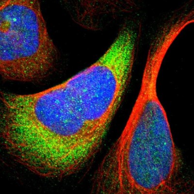 Immunocytochemistry/Immunofluorescence: RPS24 Antibody [NBP1-80803] - Immunofluorescent staining of human cell line U-2 OS shows localization to nuclear bodies, cytosol & endoplasmic reticulum.