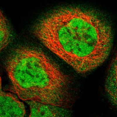 Immunocytochemistry/Immunofluorescence: ZFAND5 Antibody [NBP1-80609] - Immunofluorescent staining of human cell line A-431 shows localization to nucleoplasm & cytosol.