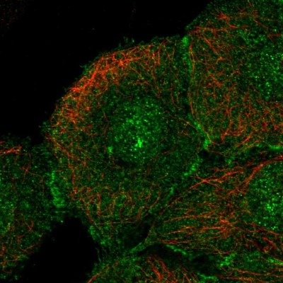 Immunocytochemistry/Immunofluorescence: CLCA2 Antibody [NBP2-33482] - Immunofluorescent staining of human cell line HaCaT shows localization to nucleus & cell junctions.