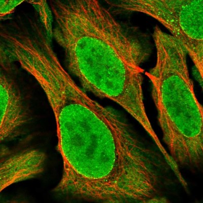 Immunocytochemistry/Immunofluorescence: CRM1 Antibody [NBP2-33381] - Immunofluorescent staining of human cell line U-2 OS shows localization to nucleus, nuclear membrane, cytosol & vesicles.
