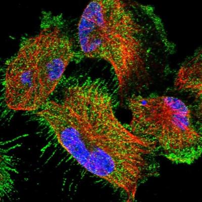 Immunofluorescence: CCDC115 Antibody [NBP1-86568] - Staining of human cell line U-251MG shows positivity in plasma membrane.