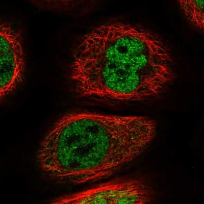 Immunocytochemistry/Immunofluorescence: WIRE Antibody [NBP1-86857] - Immunofluorescent staining of human cell line A-431 shows localization to nucleoplasm.