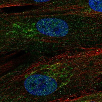 Immunocytochemistry/Immunofluorescence: RCBTB2 Antibody [NBP1-85636] - Staining of human cell line BJ shows localization to nucleus & the Golgi apparatus.