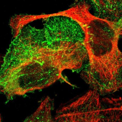 Immunocytochemistry/Immunofluorescence: PDLIM2 Antibody [NBP1-85800] - Immunofluorescent staining of human cell line U-2 OS shows localization to actin filaments & focal adhesion sites.