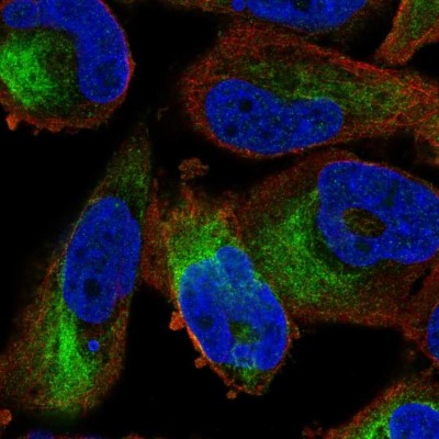 Immunocytochemistry/Immunofluorescence: ZFP95 Antibody [NBP1-86834] - Staining of human cell line RH-30 shows localization to intermediate filaments.