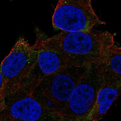 Immunocytochemistry/Immunofluorescence: Carbonic Anhydrase XIV/CA14 Antibody [NBP1-87477] - Staining of human cell line SK-MEL-30 shows localization to plasma membrane.
