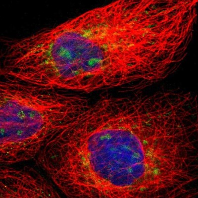 Immunocytochemistry/Immunofluorescence: Myosin light chain 3 Antibody [NBP1-88068] - Staining of human cell line A-431 shows positivity in nucleoli and mitochondria.