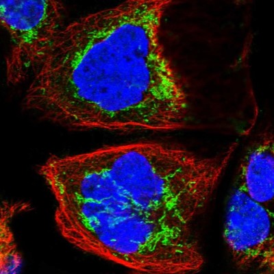Immunocytochemistry/Immunofluorescence: KLC4 Antibody [NBP1-88772] - Immunofluorescent staining of human cell line A-431 shows localization to mitochondria.