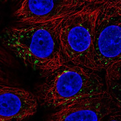 Immunocytochemistry/Immunofluorescence: SGSM3 Antibody [NBP2-13304] - Immunofluorescent staining of human cell line MCF7 shows localization to the Golgi apparatus.