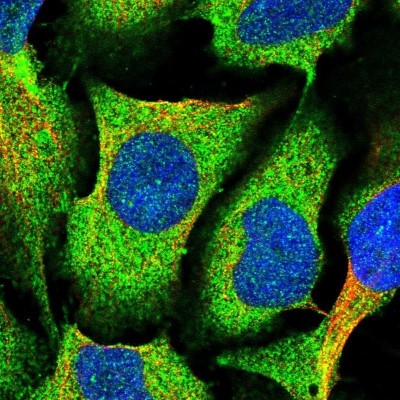 Immunocytochemistry/Immunofluorescence: MVD Antibody [NBP2-13628] - Staining of human cell line U-2 OS shows positivity in cytoplasm.