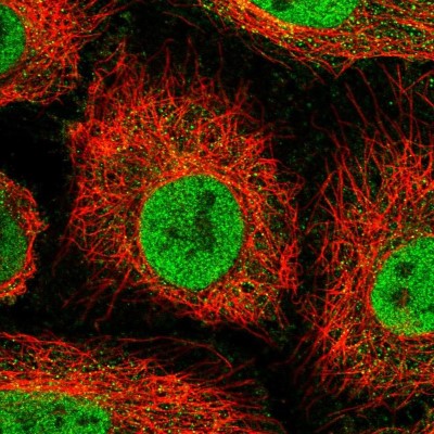 Immunocytochemistry/Immunofluorescence: OSBPL7 Antibody [NBP2-38689] - Immunofluorescent staining of human cell line HeLa shows localization to nucleoplasm & cytosol.