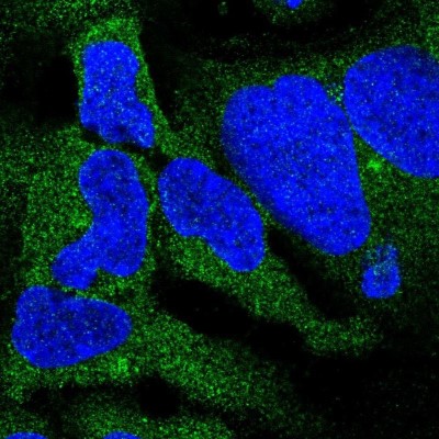 Immunocytochemistry/Immunofluorescence: DYNC1I2 Antibody [NBP2-38469] - Staining  of human cell line HEK 293 shows positivity in cytoplasm and aggresome.