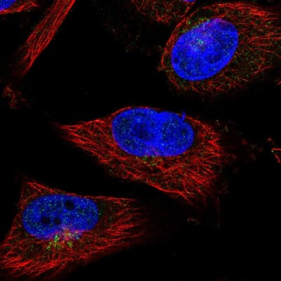 Immunocytochemistry/Immunofluorescence: SHFM3 Antibody [NBP2-14013] - Immunofluorescent staining of human cell line U-251 MG shows localization to the Golgi apparatus.