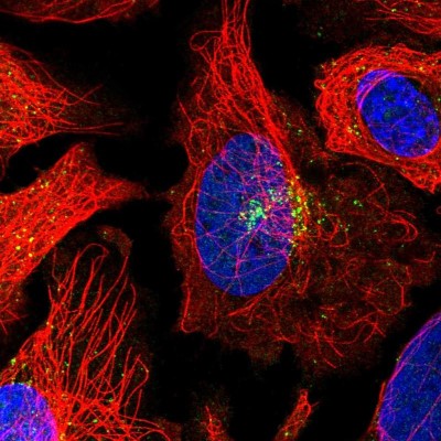 Immunocytochemistry/Immunofluorescence: GGA1 Antibody [NBP2-14047] - Immunofluorescent staining of human cell line U-2 OS shows localization to nucleoplasm & vesicles.