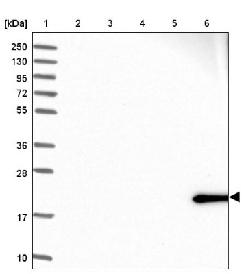 Western Blot: Proapoptotic Caspase Adaptor Protein Antibody [NBP1-92287] - Lane 1: Marker  [kDa] 250, 130, 95, 72, 55, 36, 28, 17, 10.  Lane 2: Human cell line RT-4.  Lane 3: Human cell line U-251MG sp.  Lane 4: Human plasma (IgG/HSA depleted).  Lane 5: Human liver tissue.  Lane 6: Human tonsil tissue