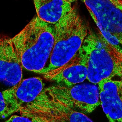Immunocytochemistry/Immunofluorescence: RPL18 Antibody [NBP2-13251] - Immunofluorescent staining of human cell line HEK 293 shows localization to nucleoli, cytosol & endoplasmic reticulum.