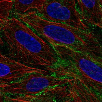 Immunocytochemistry/Immunofluorescence: BASP1 Antibody [NBP2-14347] - Immunofluorescent staining of human cell line SiHa shows localization to plasma membrane.