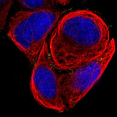 Immunocytochemistry/Immunofluorescence: TMEM149 Antibody [NBP1-93943] - Staining of human cell line A-431 shows positivity in focal adhesions.